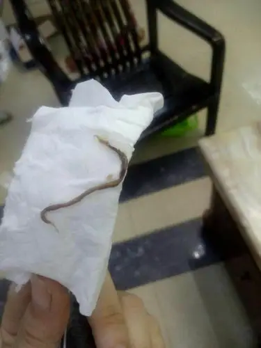 想问图片中疑是虫子的白色条状物是什么,是从瘦肉中扯出来的,之前在别