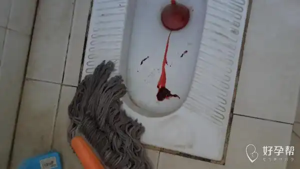 月经第二天老是会有一大块血出来,会持续到后面,,图片有点恶心