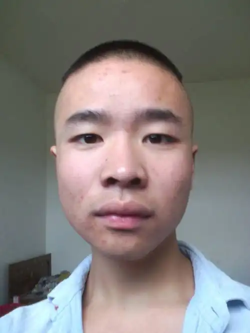 为什么我这么丑,别人叫我丑人怪,谁来救救我啊!谢谢他一家人