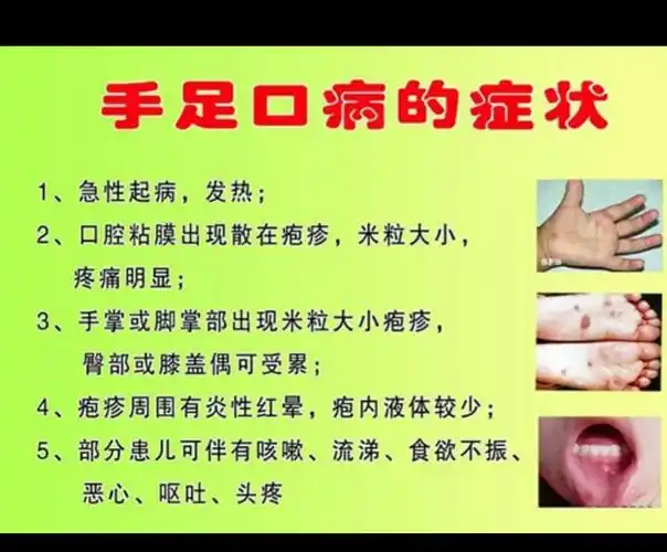 百色市右江区金都,平安幼儿园预防手足口病宣传知识