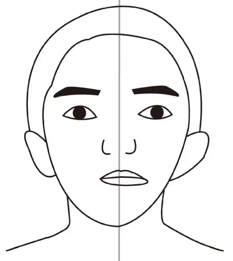 先天大小脸/半面短小畸形 人们常说的大小脸,其实也可以简单粗暴分为