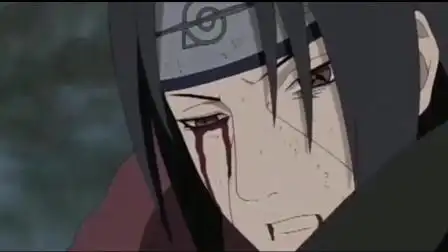 火影;宇智波鼬战斗受伤,眼睛都流血了-动漫-高清完整正版视频在线观看