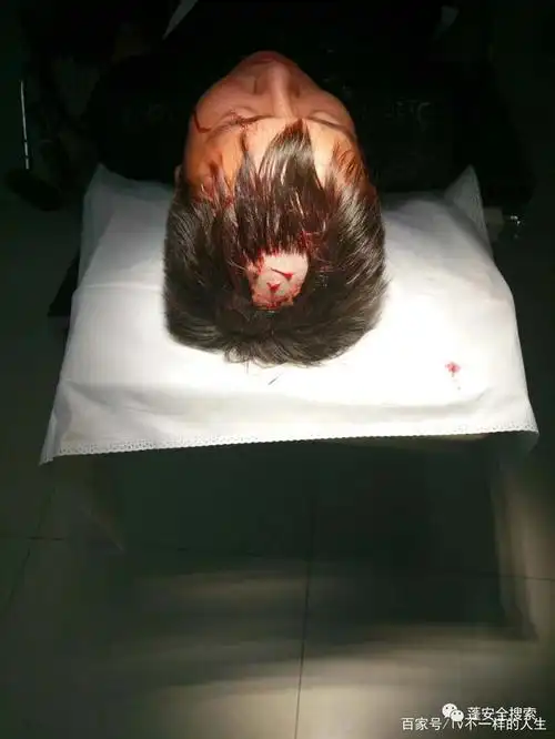 政府街房管局旁边的一家米粉店被楼上墙壁掉下来的一块瓷砖,砸伤头部