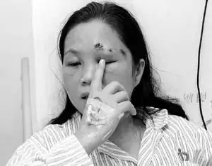 银行轮号生口角 女老板被打爆头(图)