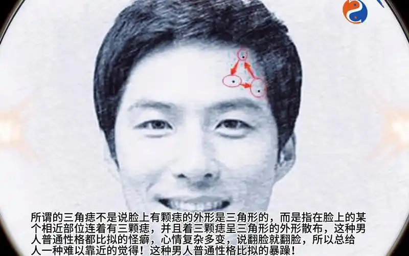 脸上有三角痣"说翻脸就翻脸"!