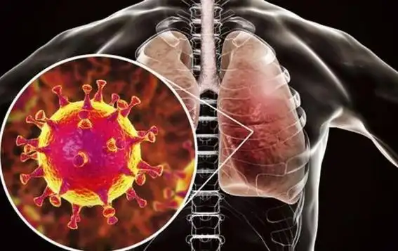 俄罗斯研发新型冠状病毒快速检测方法仅需15至20分钟确诊