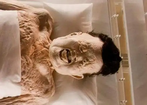 2000多年前古尸偶然出现打针时血管纹路仍鼓出皮肤柔软有弹性