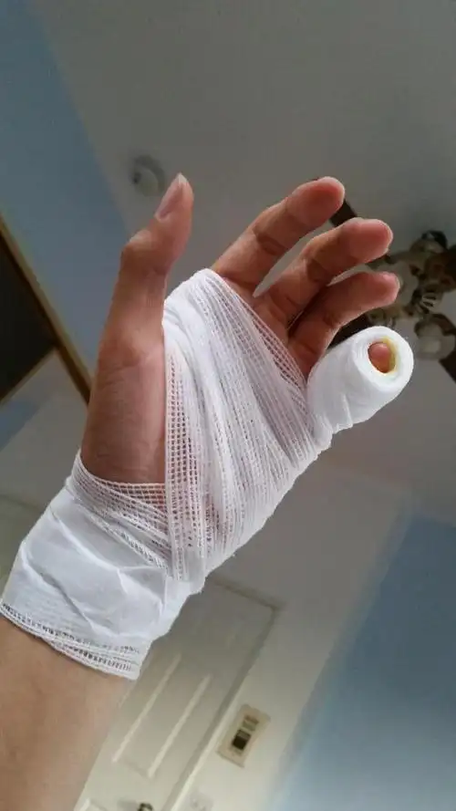 外服资讯北美clg战队ad选手doublelift手受伤缺席本周由stixxay替补