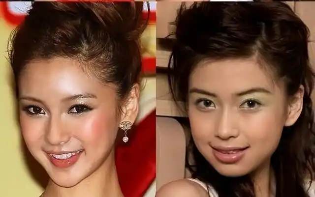 不管是普通人还是大明星,他们都会通过整容手段变得更漂亮.