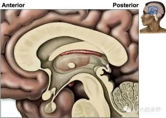 超精美!第三脑室解剖图谱