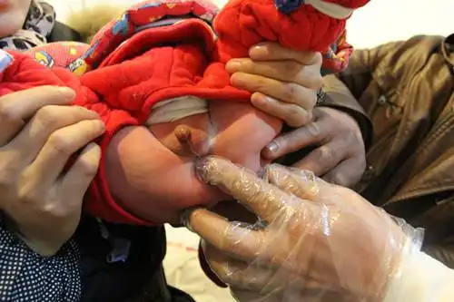 新生儿无肛父母千里寻医救命