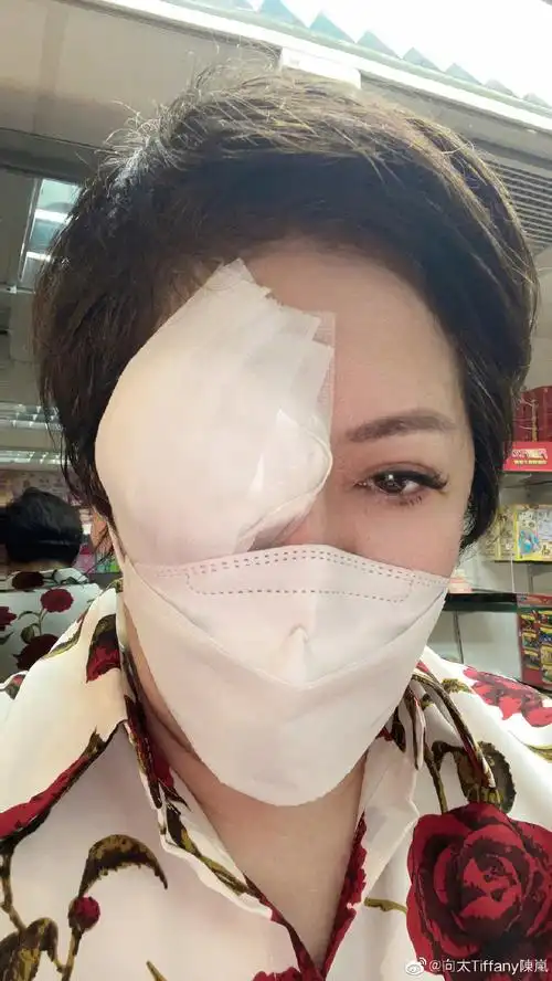 从位置来看,向太的两只眼睛应该都有装晶片,想来是散光的确如她所说