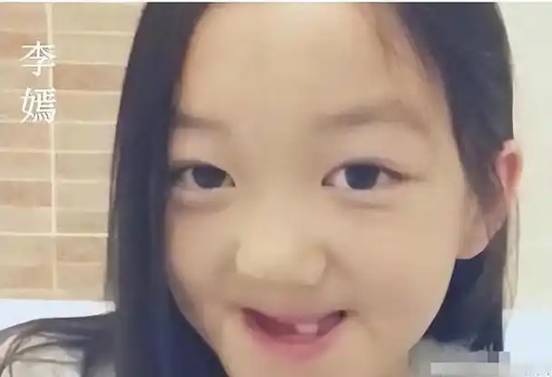 王菲女儿李嫣第4次"兔唇"修复手术成功,照片公开,美得很高级