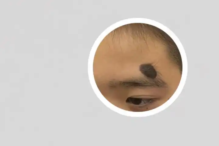 新生儿刚出生时,身体会出现一些胎记,不过胎记的大小和数量都不相同