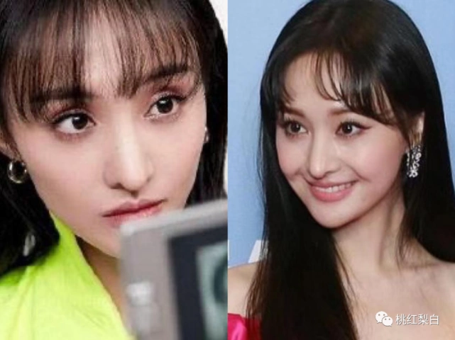 李小璐直播4小时赚2000万,可她的脸怎么又变样了