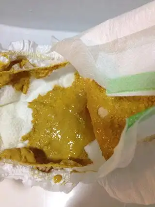 宝宝大便有水是怎么回事