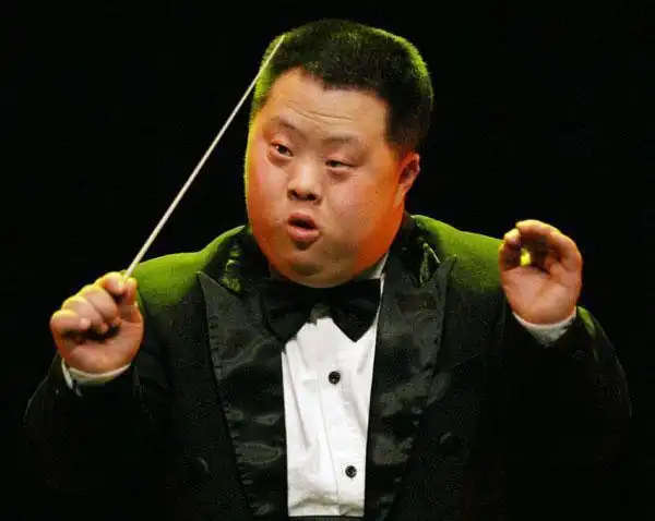 唐氏综合征是怎么引起的(唐氏综合征检查什么)_大全-幸福起航