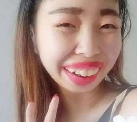 嘟嘟姐解封后风格大变真实照片龅牙和大嘴唇竟都是假的