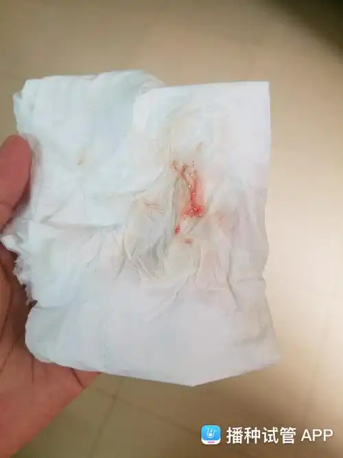 [试管婴儿]囊胚第6天出血了,感觉月经快要