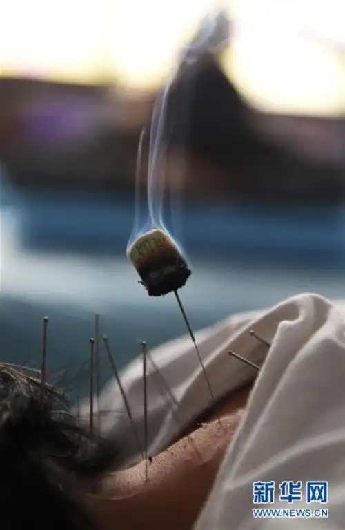 眼下随着季节变化,山东省邹平市的中医馆处处艾香飘,人们进行艾灸