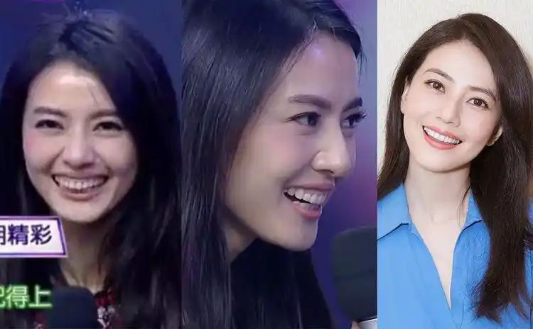 为了笑得好看 高圆圆花一年时间箍牙 摆脱大牙肉