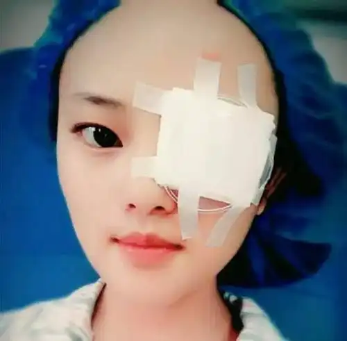 8月24日,三个月复查时,正迎来大坪医院眼科专科医院开学前的小高峰,前