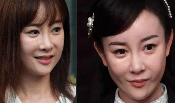 张檬自爆因整容3年无戏可拍整容原因令人唏嘘还好有爱人陪伴