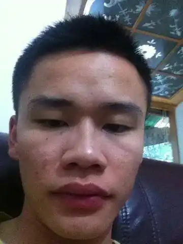 什么是蒜头鼻很多人都不知道蒜头鼻虽丑却是吉利的好面相