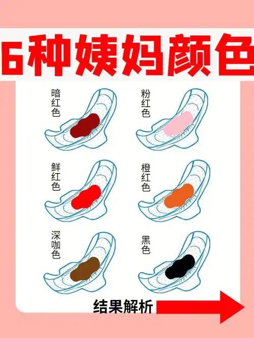 正常颜色是暗红色月经是子宫内膜,周期性脱落及出血形成的.