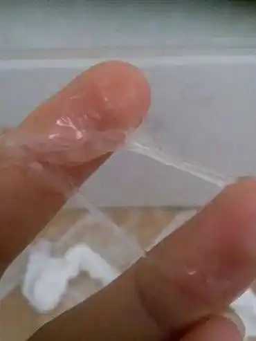 白带是由许多组织分泌的液体共同组成的,它包括尿道旁腺,前庭大腺