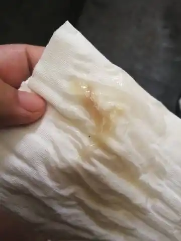 白带这样,是不是快要发动了