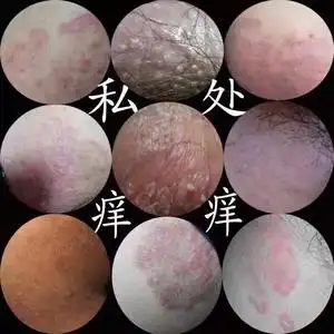 【女性阴毛痒止痒】女性阴毛痒止痒品牌,价格 - 阿里巴巴