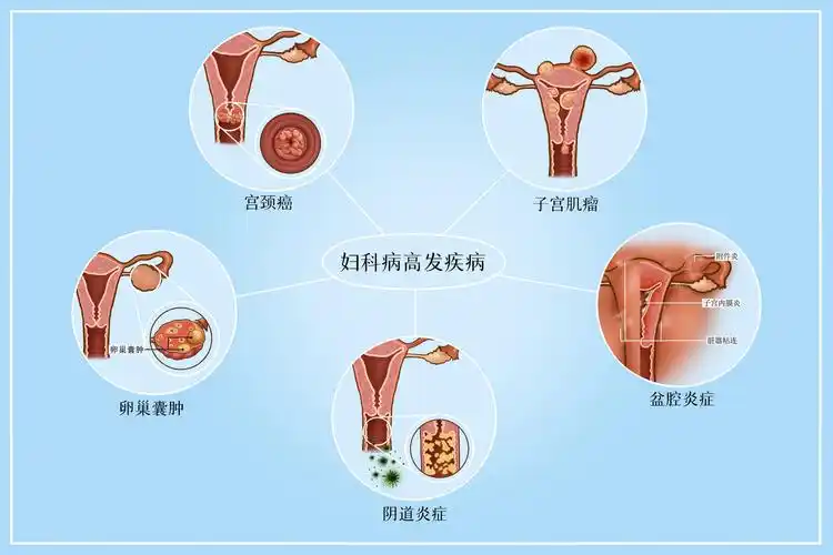 "这不经让人想问:难道一位女性的妇科病,是从性生活开始的吗?