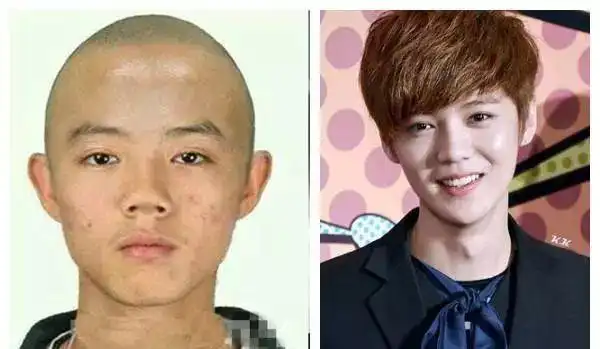 整形后脸部僵硬的当红男星第四位整容前没法看唯独他大方承认