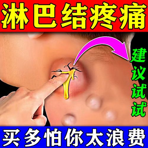 淋巴结散结膏贴淋巴结专l用颈l部耳后腋下副乳腮腺焱肿大散结淋巴贴