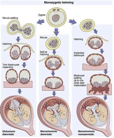 同卵双胎判断男女怀孕几周可 同卵双胞胎5个月看男女