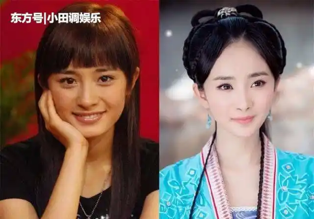 猎奇百科爱美是人的本性,娱乐圈里的明星更是留意自体态象,是以整容是