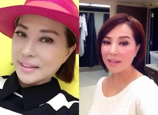 叶瑷菱罹带状疱疹「皮开肉绽」 每晚崩溃哭喊!