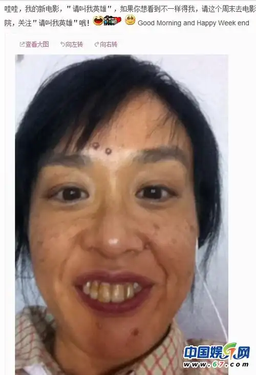 性感尤物钟丽缇自曝丑照 烂脸龅牙残成大妈(组图)