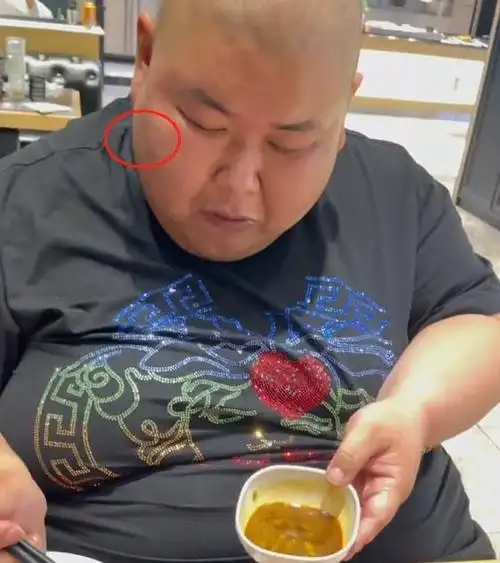 更重要的是,曾经出现在泡泡龙脸上的黑斑,也出现在了大宝脸上.