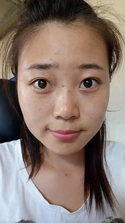 怎么去掉斑,这个是我小时候长的七岁吧!