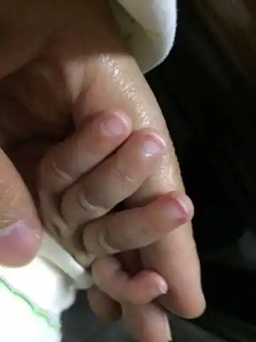 四个半月宝宝指甲发白怎麼回事?