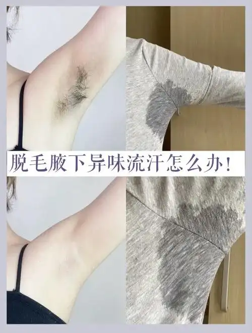腋下出汗,腋臭很尴尬?有什么可以解决的办法?