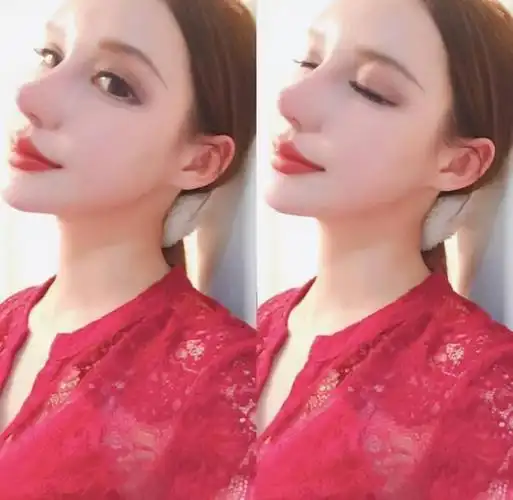 网红"猫妹妹"整容失败,直播称自己特后悔,后期鼻子要修复多次