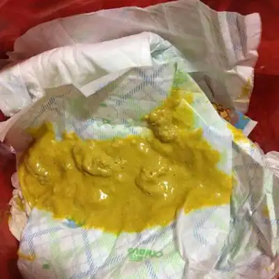 宝妈们,宝宝大便很稀有水,怎麼回事