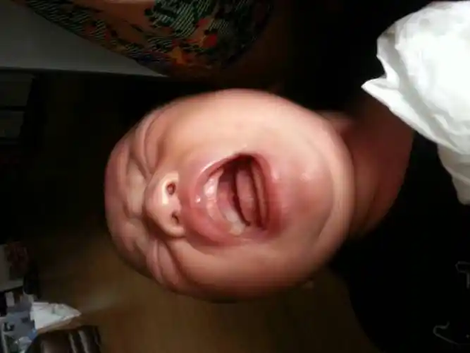 问:宝宝上颚两边有白色和黄色的黏膜,感觉不是鹅口疮,这是什么,宝宝