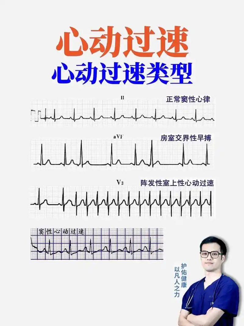 心律失常中心动过速图文详解,心电图分析.#心律失常 #心电图 - 抖音