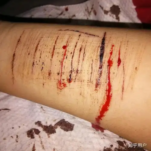 自残的人是什么心理? - 知乎