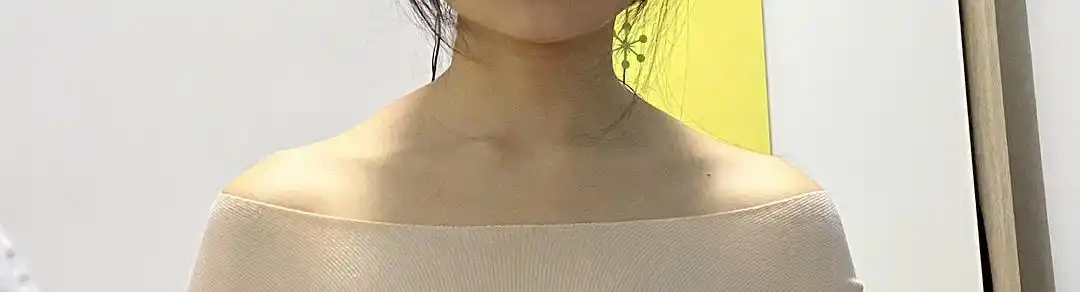 【交流】斜方肌有鼓包,按着好疼,姐妹们知道什么办法消得比较快吗?