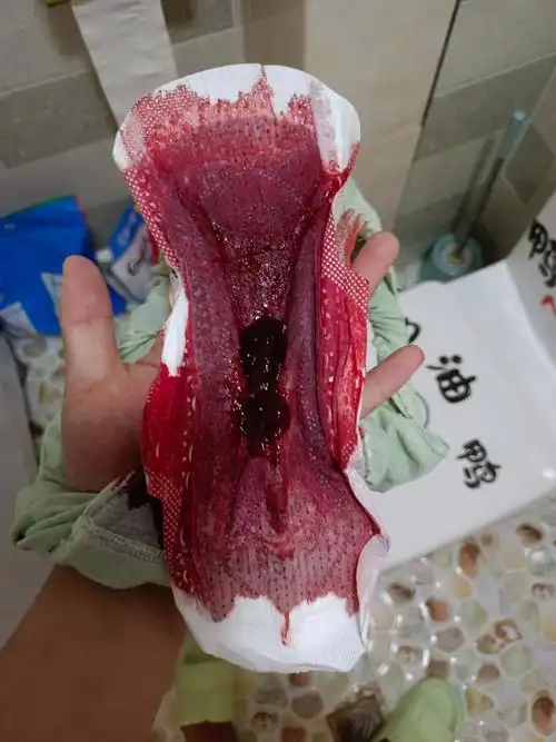 7月8号用试纸测出两道杠,7月18号10点上厕所突然白带带血,12点血量